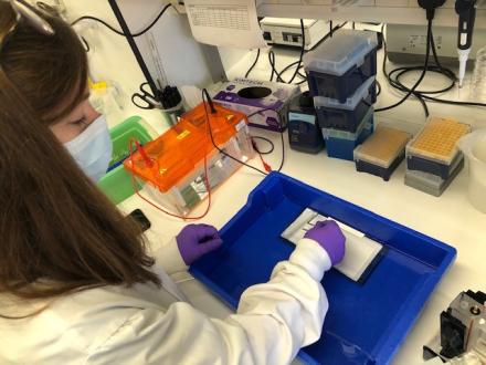 Setting up a Western blot transfer